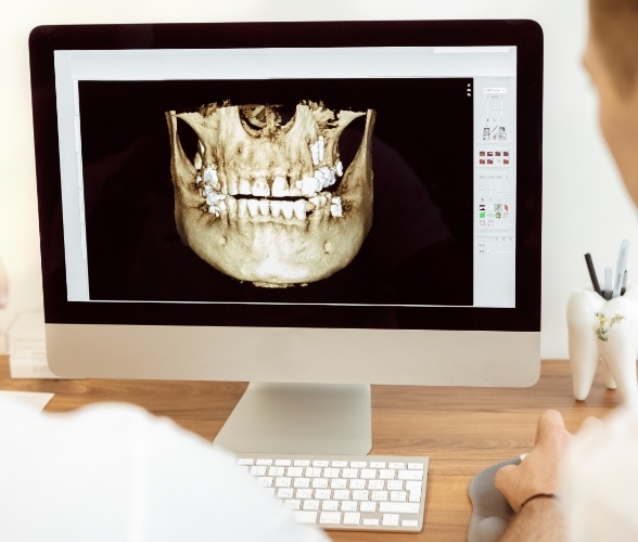 Advanced digital x-rays of jaw and smile